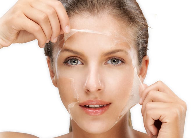 Peeling