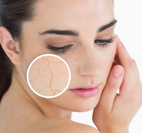 Skinboosters