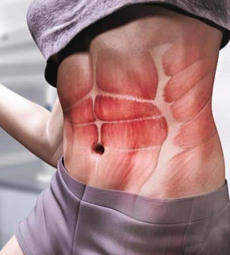 flacidez muscular