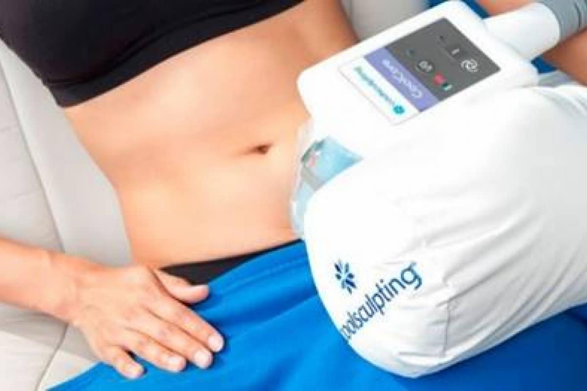 coolsculpting