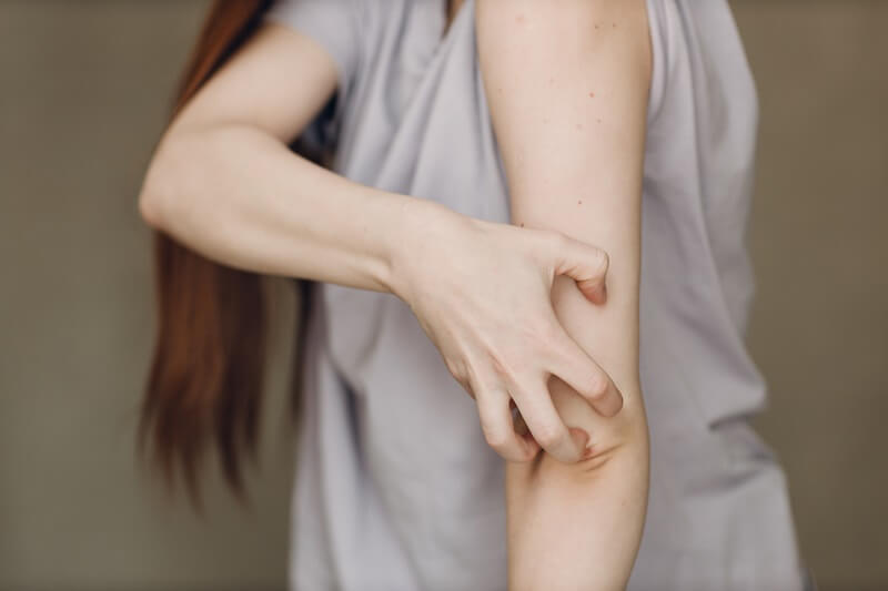 O que é dermatite de contato? Como tratar? 1 Os desencadeadores comuns incluem sabões e detergentes