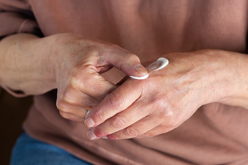 O que é dermatite de contato? Como tratar? 2 O médico pode avaliar o tipo de dermatite de contato que está ocorrendo e oferecer um plano de tratamento personalizado